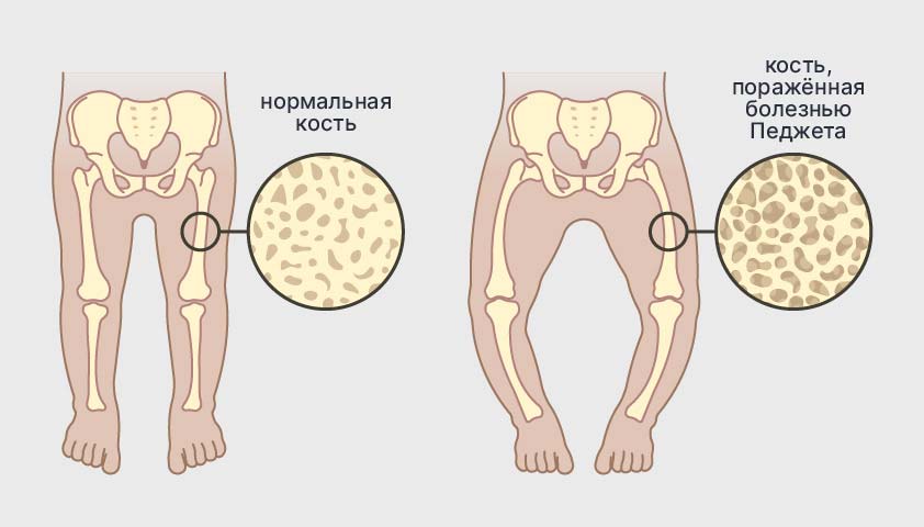 Кость