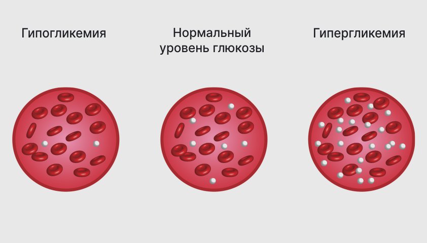 Периодонтит — симптомы, классификация, лечение