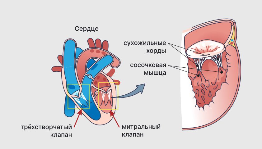 Недостаточность митрального клапана - что это, какие степени, причины