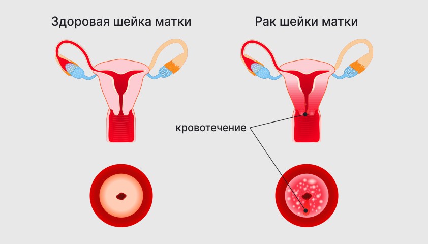 Шейка матки — как выглядит у женщины, где находится, нормы длины